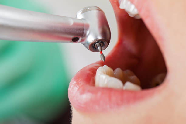 Best Emergency Dental Filling Replacement  in Noyack, NY